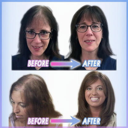 Aplique Cabelo Clip In Volume Natural Cobertura Falhas Topo
