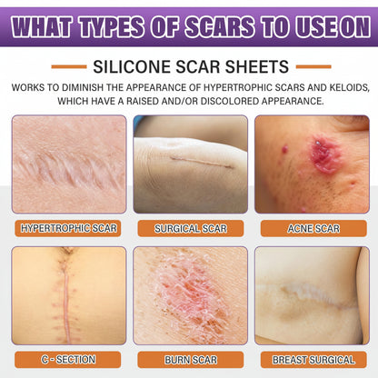 Scar Sheets Silicone Medical Grade Reusable Scar Treatment Tape