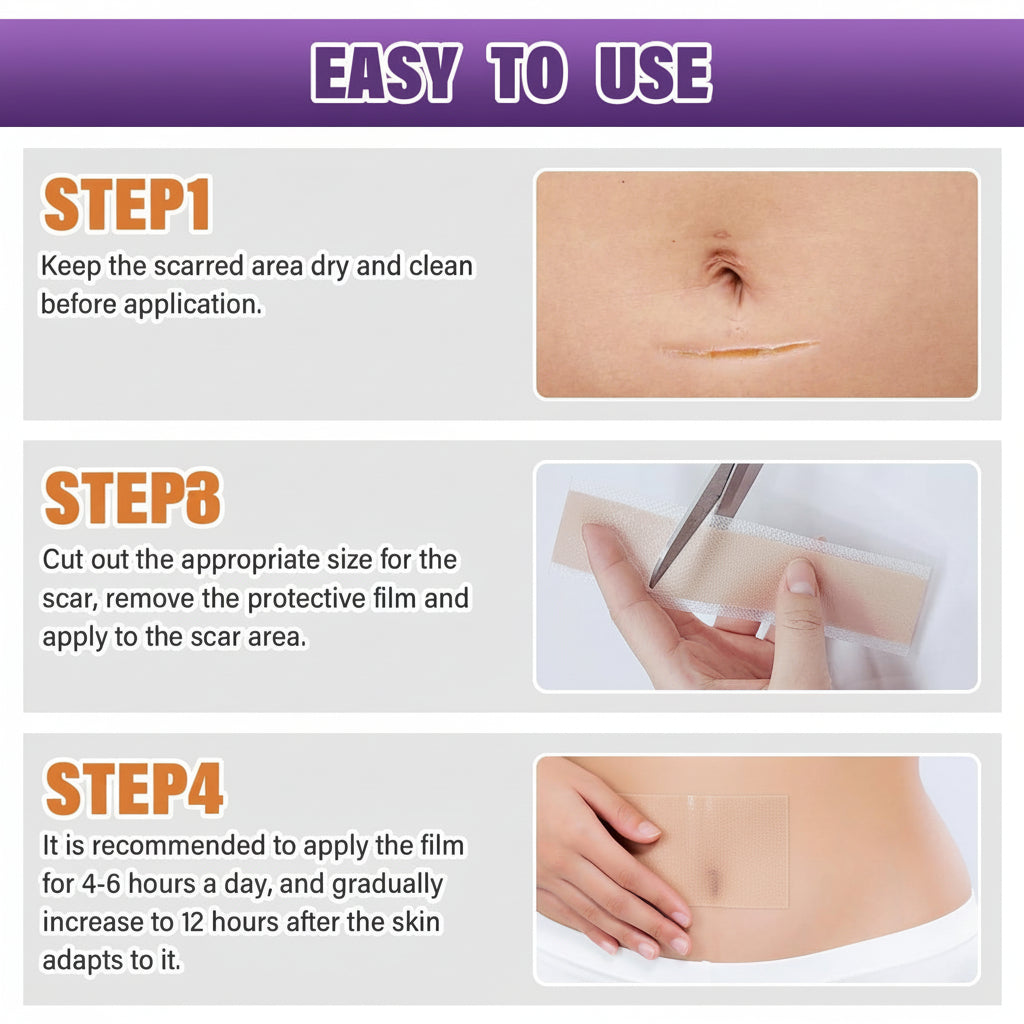 Scar Sheets Silicone Medical Grade Reusable Scar Treatment Tape