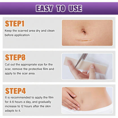Scar Sheets Silicone Medical Grade Reusable Scar Treatment Tape