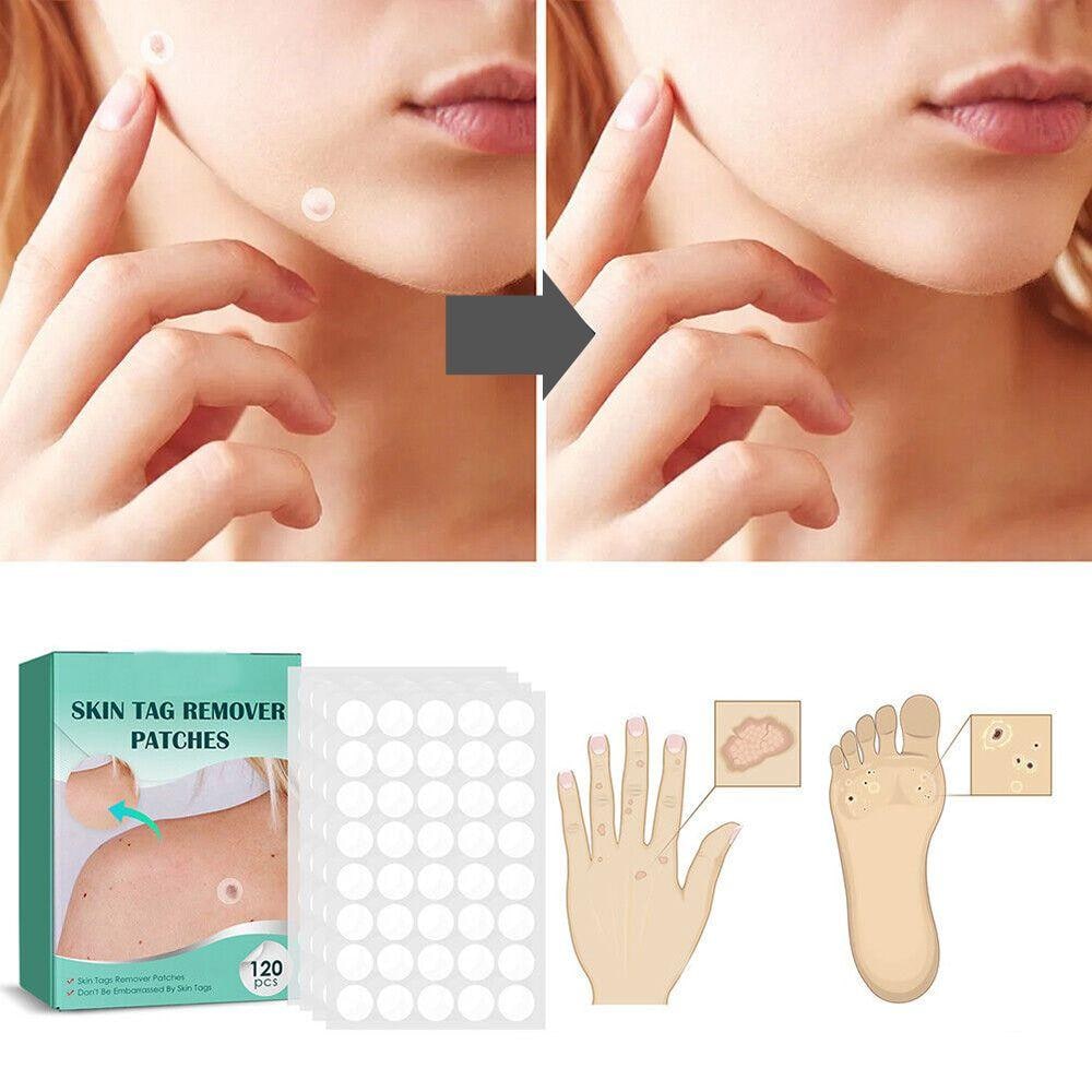 Skin Tag Remover Hydrocolloid Patches - Image 6